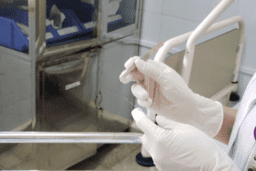 CẤY CHỈ TRONG ĐIỀU TRỊ THOÁT VỊ ĐĨA ĐỆM CỘT SỐNG THẮT LƯNG