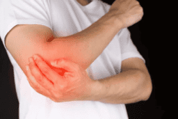 SIÊU ÂM TRONG CHẨN ĐOÁN HÌNH ẢNH GIÚP ĐÁNH GIÁ TỔN THƯƠNG KHỚP KHUỶU